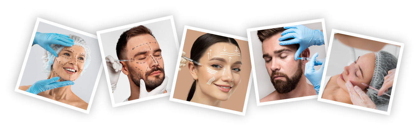 Harmonização Facial em Curitiba/PR - Dentvidamed Centro Cívico - Fotos de Tratamentos